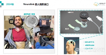 植入式脑机接口,开启意识与AI融合的可能性(图3) 植入式脑机接口,开启意识与AI融合的可能性(图3)