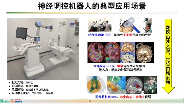 芯片自主可控,让中国脑机接口创新医疗器械研发取得新突破(图10) 芯片自主可控,让中国脑机接口创新医疗器械研发取得新突破(图10)